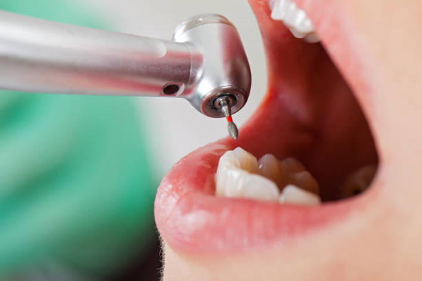 Best Emergency Care for Gum Disease in Marlboro Meadows, MD
